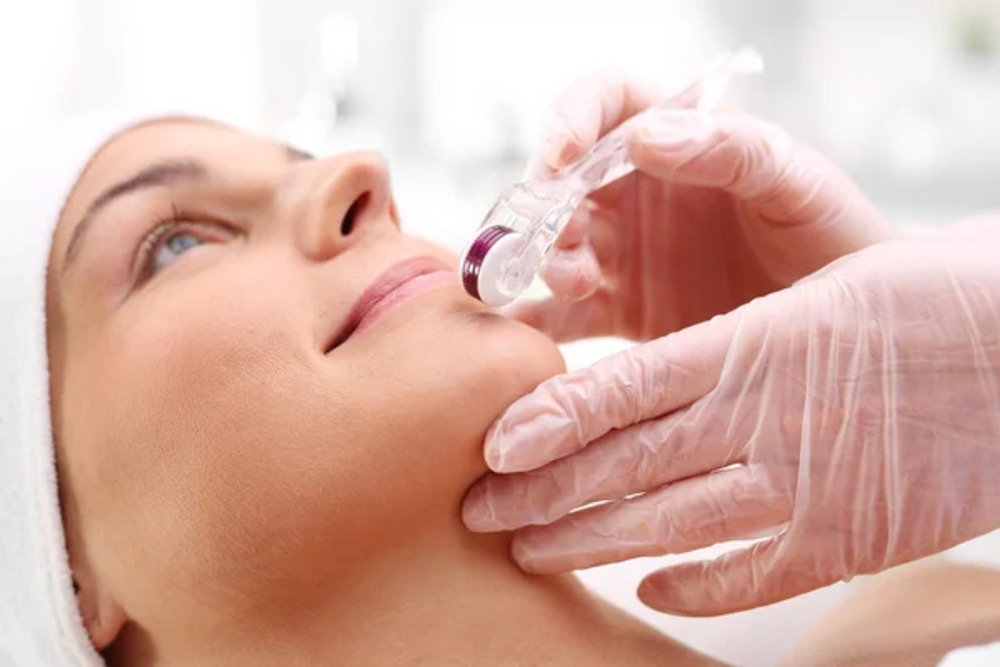 Microneedling Small.4 jpg